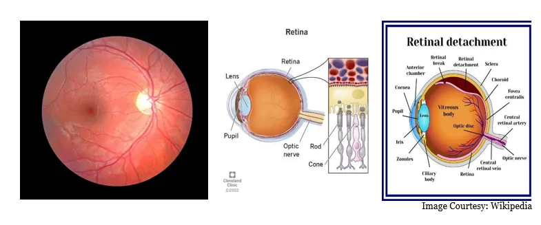 Eye Diagnostics Technology